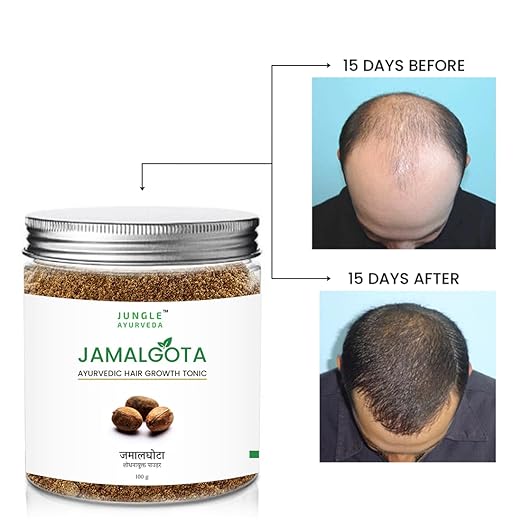 🌿 Jamalgota Ayurvedic Hair Growth Powder Buy 1 Get 1 Free🌿